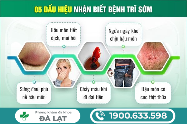 Hình ảnh minh họa